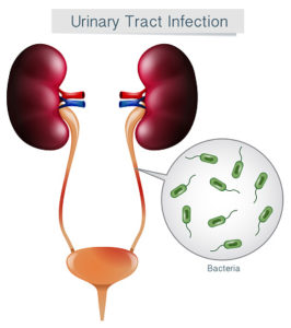 Urinary Tract Infection